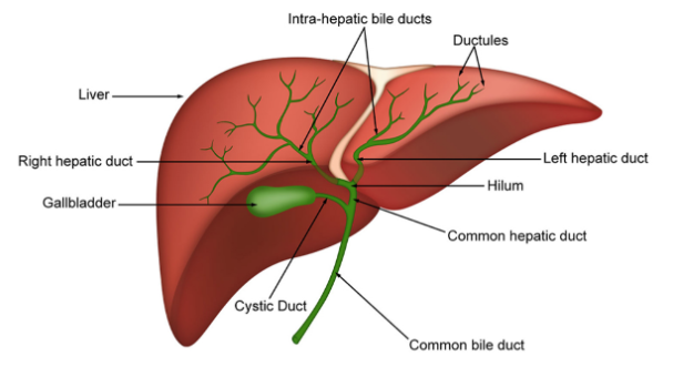 มะเร็งท่อน้ำดี
