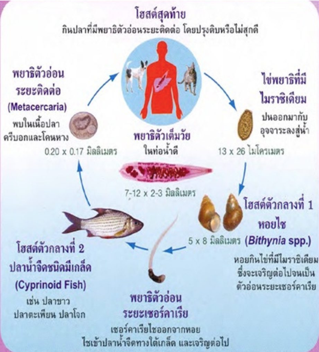 มะเร็งท่อน้ำดี